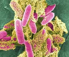 E. Coli - Bactéria que mata pessoas na Europa causa impácto negativo no setor agropecuário.